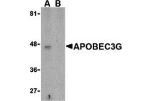 Western Blotting (WB) image for anti-Apolipoprotein B mRNA Editing Enzyme, Catalytic Polypeptide-Like 3G (APOBEC3G) (N-Term) antibody (ABIN1031236) (APOBEC3G anticorps  (N-Term))