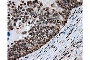 Immunohistochemical staining of paraffin-embedded colon tissue using anti-MTRF1L mouse monoclonal antibody. (MTRF1L anticorps)
