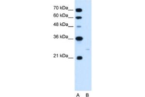 Western Blotting (WB) image for anti-MAX Interactor 1 (MXI1) antibody (ABIN2460213) (MXI1 anticorps)