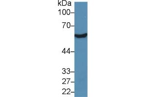 Western blot analysis of Rat Liver lysate, using Human ALDH7A1 Antibody (5 µg/ml) and HRP-conjugated Goat Anti-Rabbit antibody ( (ALDH7A1 anticorps  (AA 1-539))