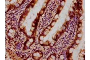 Immunohistochemical of paraffin-embedded human small intestinal tissue using ABIN7153439 at dilution of 1:100 (Galectin 3 anticorps)