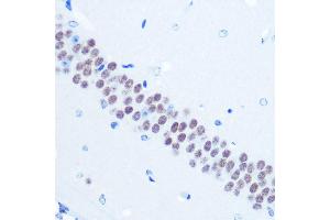 anti-Transducin-Like Enhancer of Split 1 (E(sp1) Homolog, Drosophila) (TLE1) antibody