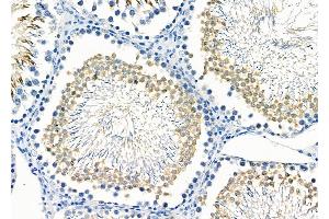 ABIN6265738 and ABIN6266686 at 1/100 staining Rat testis tissue by IHC-P.