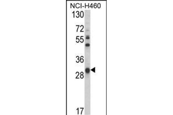 GSTO1 anticorps  (AA 126-155)