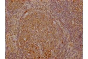 IHC image of ABIN7172255 diluted at 1:100 and staining in paraffin-embedded human lymph node tissue performed on a Leica BondTM system.
