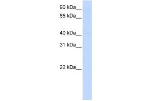 WB Suggested Anti-ERCC8 Antibody Titration: 0. (ERCC8 anticorps  (Middle Region))