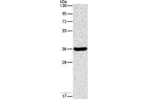 Western blot analysis of Human fetal liver tissue, using FGL1 Polyclonal Antibody at dilution of 1:1050 (FGL1 anticorps)