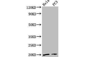 Western Blot Positive WB detected in: Hela whole cell lysate, PC-3 whole cell lysate All lanes: NDUFAF2 antibody at 2. (NDUFAF2 anticorps  (AA 117-169))