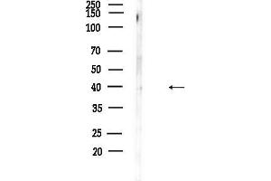 anti-LIM Homeobox 8 (LHX8) (Internal Region) antibody
