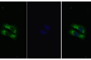 Detection of IL22R in Human HepG2 cell using Polyclonal Antibody to Interleukin 22 Receptor (IL22R) (IL22 Receptor alpha 1 anticorps  (AA 267-565))