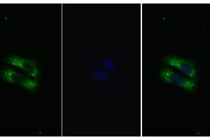 Detection of IL22R in Human HepG2 cell using Polyclonal Antibody to Interleukin 22 Receptor (IL22R) (IL22R anticorps  (AA 267-565))