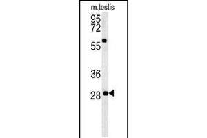 Western blot analysis in mouse testis tissue lysates (35ug/lane). (GSTO2 anticorps  (AA 82-110))