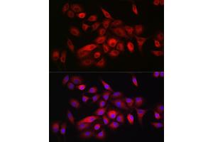 Immunofluorescence analysis of A-549 cells using CD55 Rabbit pAb1 (ABIN3021784, ABIN3021785, ABIN3021786 and ABIN6215890) at dilution of 1:150 (40x lens).