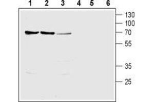 Western blot analysis of rat kidney (lanes 1 and 4), rat liver (lanes 2 and 5) and mouse kidney (lanes 3 and 6) lysates: - 1-3. (SLC28A1 anticorps  (Intracellular, N-Term))