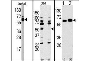 Image no. 1 for anti-Ribosomal Protein S6 Kinase, 70kDa, Polypeptide 1 (RPS6KB1) (Middle Region) antibody (ABIN358256) (RPS6KB1 anticorps  (Middle Region))