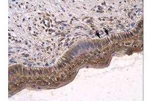 Image no. 3 for anti-Sirtuin 5 (SIRT5) (C-Term) antibody (ABIN6735783)