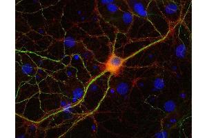 Indirect immunostaining of PFA fixed rat hippocampus neurons with anti-NSF (dilution 1 : 500; red) and mouse anti-MAP 2 (, dilution 1 : 1000; green). (NSF anticorps  (AA 733-744))