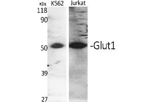 Western Blot analysis of K562 (1), Jukat (2), diluted at 1:500.