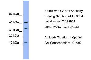 WB Suggested Anti-CASP6  Antibody Titration: 0. (Caspase 6 anticorps  (Middle Region))