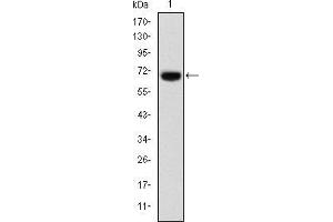 Western blot analysis using FOXP2 mAb against human FOXP2 (AA: 47-287) recombinant protein. (FOXP2 anticorps)
