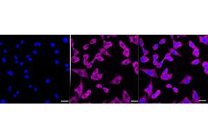 anti-Charged Multivesicular Body Protein 3 (CHMP3) antibody