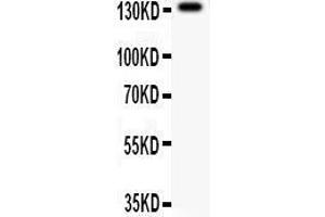 Anti- NMDAR2C Picoband antibody, Western blotting All lanes: Anti NMDAR2C  at 0. (GRIN2C anticorps  (AA 43-242))