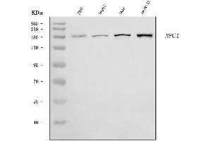 Western blot analysis of Niemann Pick C1/NPC1 using anti-Niemann Pick C1/NPC1 antibody (ABIN7603074).
