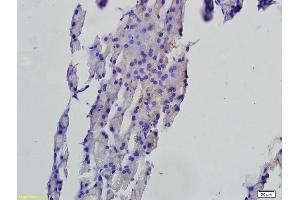 Formalin-fixed and paraffin embedded rat pancreas tissue labeled with Anti-FAF1 Polyclonal Antibody, Unconjugated (ABIN675309) followed by conjugation to the secondary antibody and DAB staining