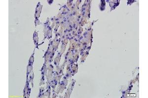 Formalin-fixed and paraffin embedded rat pancreas tissue labeled with Anti-FAF1 Polyclonal Antibody, Unconjugated (ABIN675309) followed by conjugation to the secondary antibody and DAB staining (FAF1 anticorps  (AA 551-650))