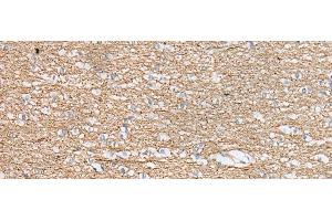 Immunohistochemistry of paraffin-embedded Human brain tissue using IDO2 Polyclonal Antibody at dilution of 1:45(x200) (IDO2 anticorps)