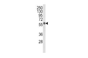 Western blot analysis of ALDH3B1 Antibody (Center) (ABIN652651 and ABIN2842437) in MDA-M cell line lysates (35 μg/lane).