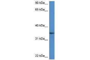 WB Suggested Anti-Dhrs3 Antibody   Titration: 1. (DHRS3 anticorps  (Middle Region))