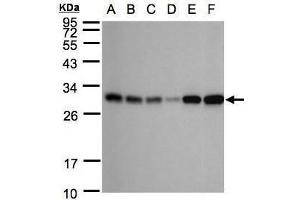 WB Image Sample(30 ug whole cell lysate) A: 293T B: A431 , C: H1299 D: HeLa S3 , E: Hep G2 , F: Raji , 12% SDS PAGE antibody diluted at 1:1000 (AK4 anticorps)