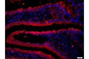 Formalin-fixed and paraffin-embedded mouse intestine labeled with Anti-CD19 Polyclonal Antibody, Unconjugatedused at 1:200 dilution for 40 minutes at 37°C.