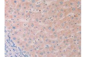 IHC-P analysis of Human Liver Tissue, with DAB staining. (PROS1 anticorps  (AA 481-667))