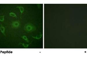 Immunofluorescence analysis of HepG2 cells, using IFNAR1 polyclonal antibody . (IFNAR1 anticorps)