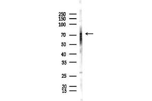 anti-Leucine Rich Repeat Neuronal 1 (LRRN1) (C-Term) antibody