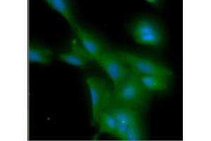 ICC/IF analysis of MYD88 in A549 cells line, stained with DAPI (Blue) for nucleus staining and monoclonal anti-human MYD88 antibody (1:100) with goat anti-mouse IgG-Alexa fluor 488 conjugate (Green).
