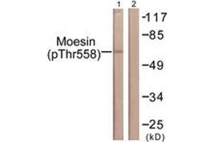 Western blot analysis of extracts from NIH-3T3 cells, using Moesin/Ezrin/Radixin (Phospho-Thr558) Antibody. (Moesin/ezrin/radixin (AA 524-573), (pThr558) anticorps)