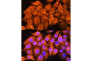 Immunofluorescence analysis of HeLa cells using  Rabbit pAb  at dilution of 1:100.
