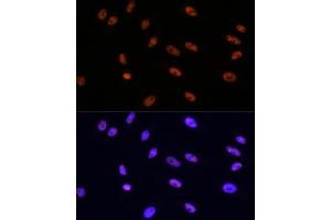 Immunofluorescence analysis of HeLa cells using MITF Rabbit mAb (ABIN7268511) at dilution of 1:100 (40x lens).