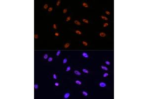Immunofluorescence analysis of HeLa cells using MITF Rabbit mAb (ABIN7268511) at dilution of 1:100 (40x lens). (MITF anticorps)