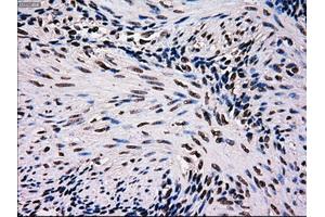 Immunohistochemical staining of paraffin-embedded pancreas tissue using anti-MRI1mouse monoclonal antibody. (MRI1 anticorps)