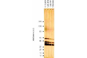 Western Blotting (WB) image for anti-ICP36 DNA Binding Protein (CMV ICP36) antibody (ABIN265543) (ICP36 DNA Binding Protein (CMV ICP36) anticorps)