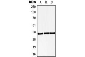 Western blot analysis of STARD10 expression in HEK293T (A), Raw264.