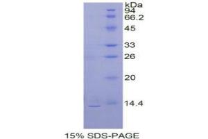 SDS-PAGE analysis of Prokineticin 2 Protein. (PROK2 Protéine)