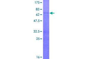 Image no. 1 for Mitochondrial Trans-2-Enoyl-CoA Reductase (MECR) (AA 1-373) protein (GST tag) (ABIN1310626)