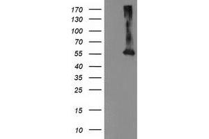 Western Blotting (WB) image for anti-Makorin Ring Finger Protein 1 (MKRN1) antibody (ABIN1499487) (MKRN1 anticorps)