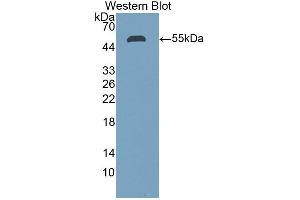 Detection of Recombinant STC1, Human using Polyclonal Antibody to Stanniocalcin 1 (STC1) (Stanniocalcin 1 anticorps  (AA 28-247))