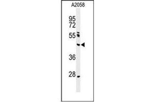Western blot analysis of NEIL1 Antibody (Center) in A2058 cell line lysates (35ug/lane). (NEIL1 anticorps  (Middle Region))
